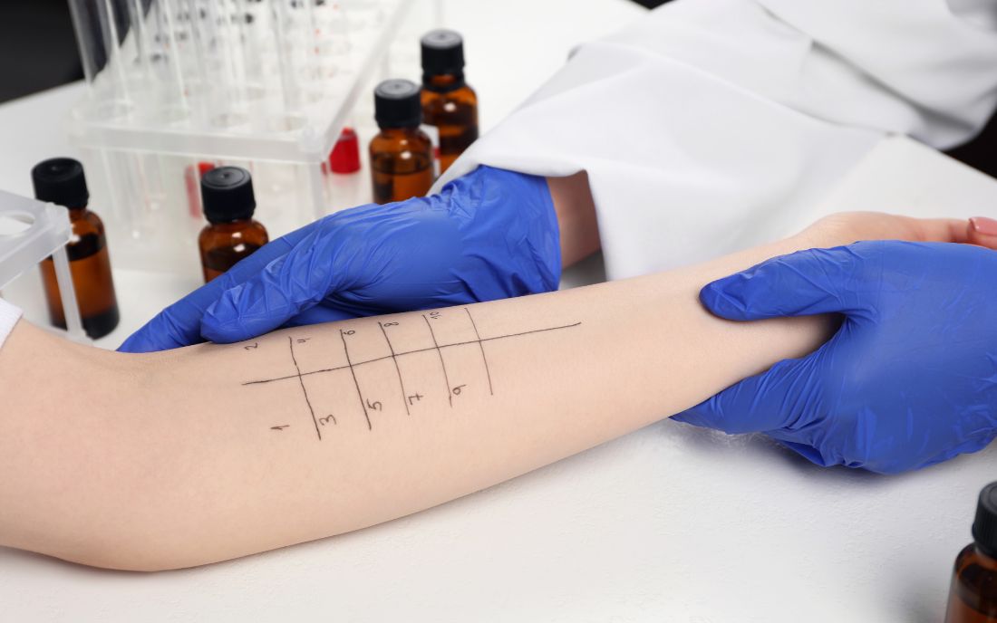 Allergologia e Immunologia Bologna - Poliambulatorio Agresti