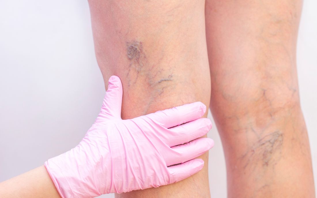 Chirurgia vascolare Poliambulatorio Agresti Bologna