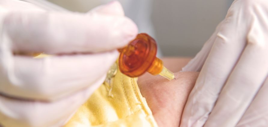 Rimozione-smagliature-Bologna-metodi-combinati-Poliambulatorio-Agresti