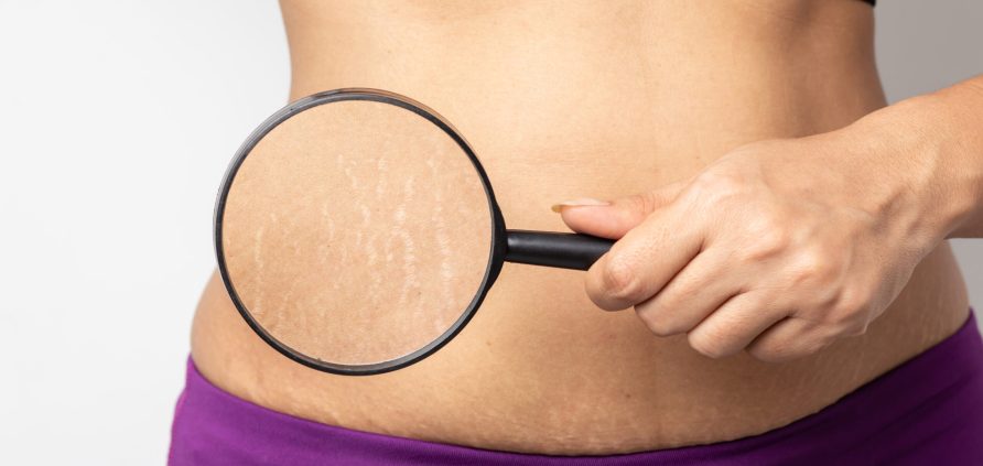 Ringiovanimento cutaneo