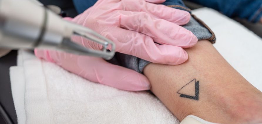 Tatuaggi Poliambulatorio Agresti Bologna