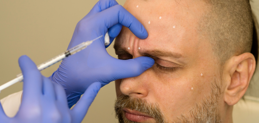 La Tossina botulinica